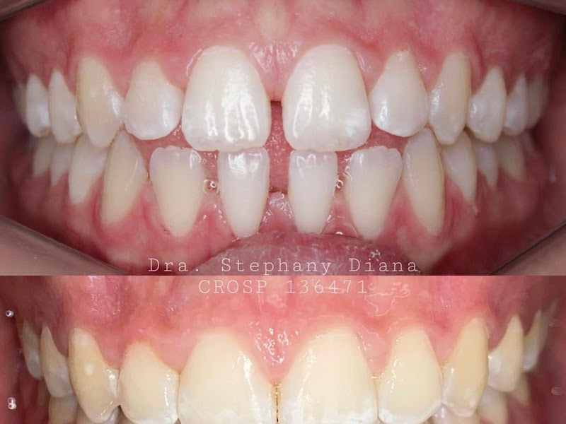 Foto 3 de Dr. Ewerton Santana / Dentista em São Caetano do Sul