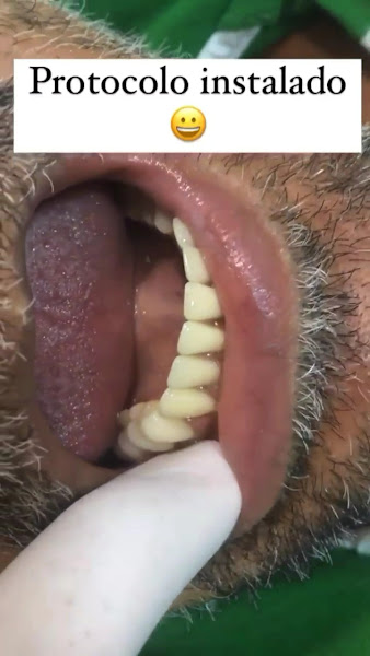 Foto 3 de Dr. Ezequiel Dos Santos | Dentista | Harmonização orofacial | Implantes - Manaus, AM