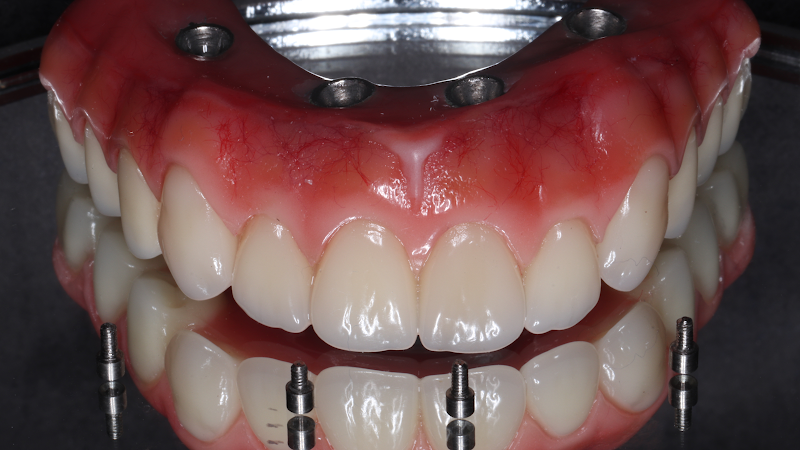 Foto 2 de Dr. Fabiano Jamil Murad | Especialista em Implantes Dentários e Prótese Protocolo em São Paulo - Dentista