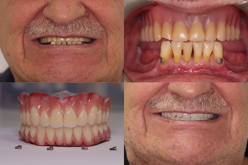 Foto 3 de Dr. Fabiano Jamil Murad | Especialista em Implantes Dentários e Prótese Protocolo em São Paulo - Dentista