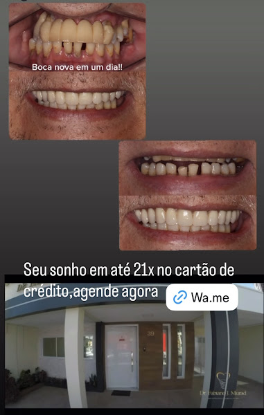 Foto 3 de Dr. Fabiano Jamil Murad - Especialista em Implantes Dentários e Reabilitação Oral | Indaiatuba - Dentista