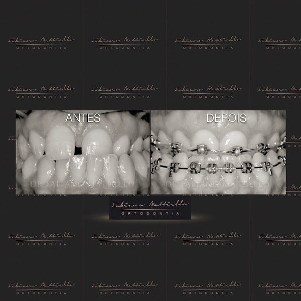 Foto 2 de Dr. Fabiano Mattiello | Mont'Serrat - Porto Alegre - RS | Especialista em aparelho ortodôntico