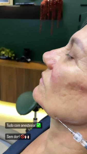 Foto 3 de Dr. Fabio Gelonese - Harmonização Facial em Bauru e São Paulo