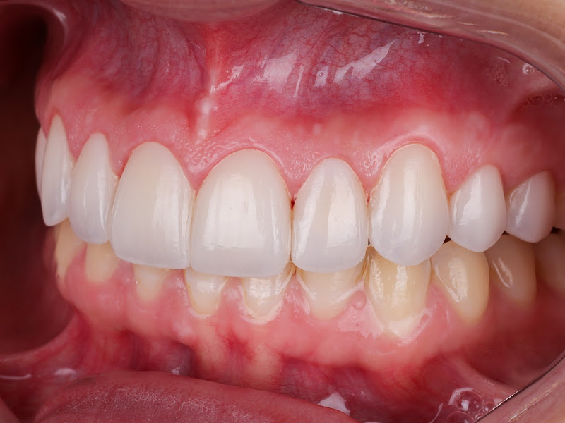 Foto 2 de Dr. Fabio Jácome - Harmonização Orofacial