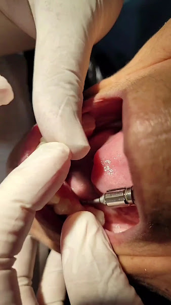 Foto 3 de Dr. Fábio Motta — Cirurgião Bucomaxilofacial e Implantodontista