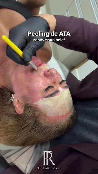 Foto 3 de Dr. Fabio Risso | Harmonização Facial e Corporal