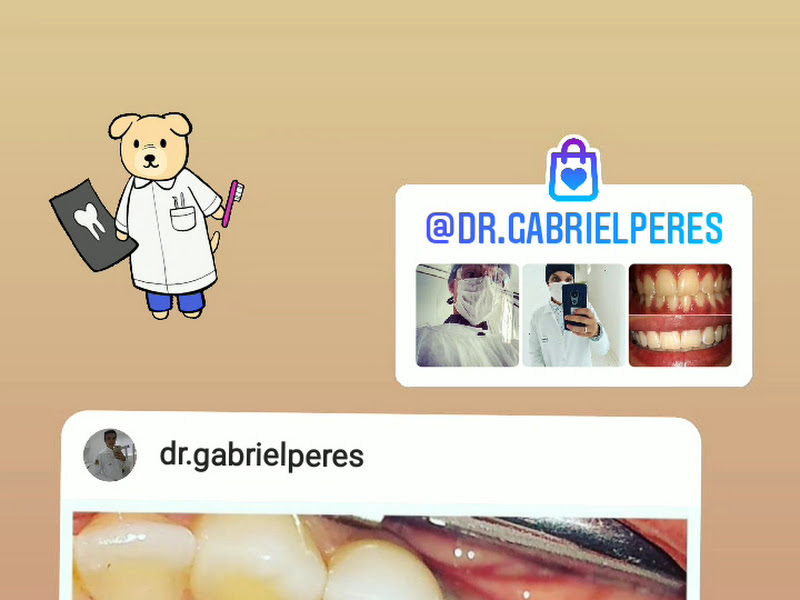 Foto 3 de Dr. Fabricio Costa | Dentista em Franca SP | Implante Dentário em Franca SP | Lentes em Resina Dental