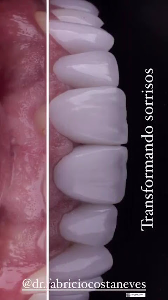 Foto 3 de Dr. Fabricio Neves Odontologia - Dentista em Mogi das Cruzes