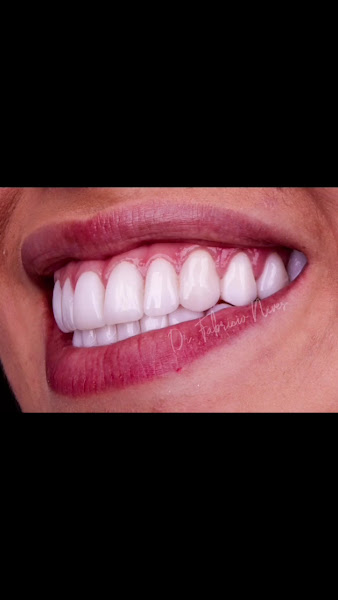 Foto 4 de Dr. Fabricio Neves Odontologia - Dentista em Mogi das Cruzes