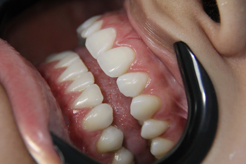 Foto 2 de Dr. Felipe Azevedo - Dentista em Cabo Frio