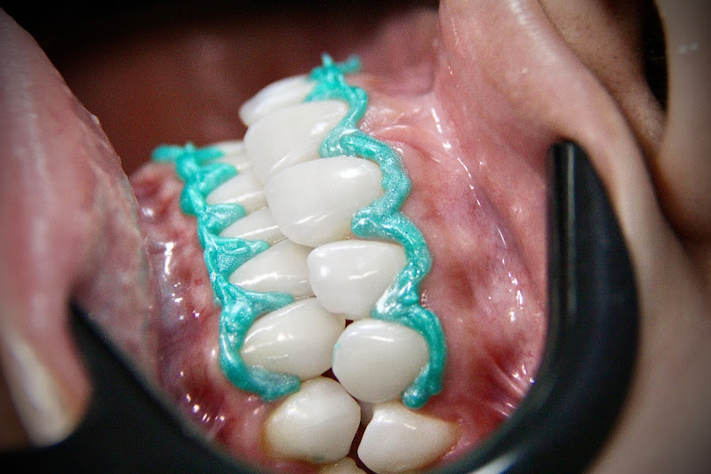 Foto 3 de Dr. Felipe Azevedo - Dentista em Cabo Frio