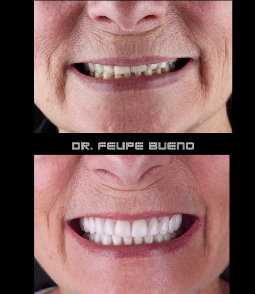 Foto 3 de Dr Felipe Bueno Odontologia Avançada