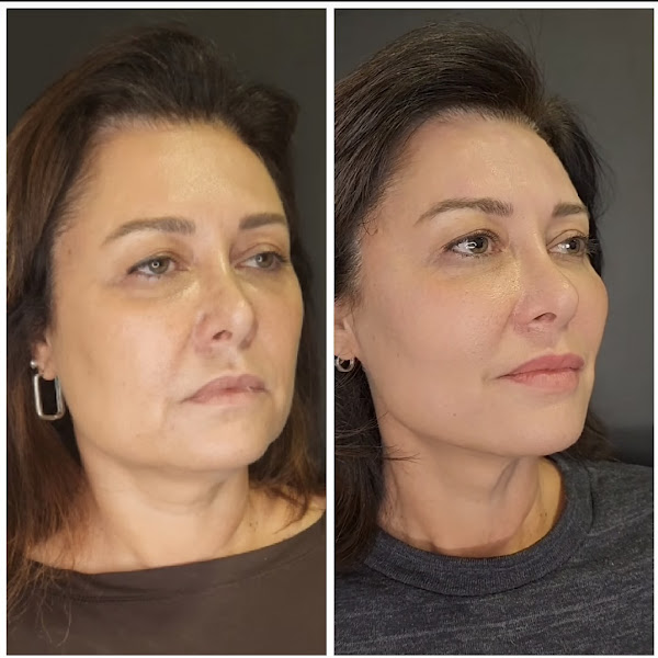 Foto 3 de Dr Felipe Farah - Harmonização Facial