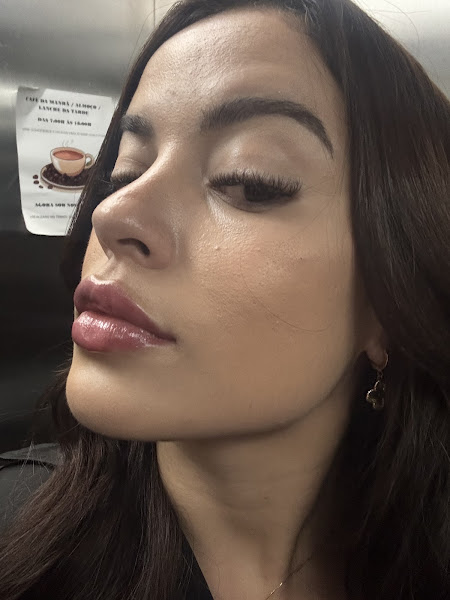 Foto 3 de Dr Felipe Genuíno - Harmonização Facial em São Paulo