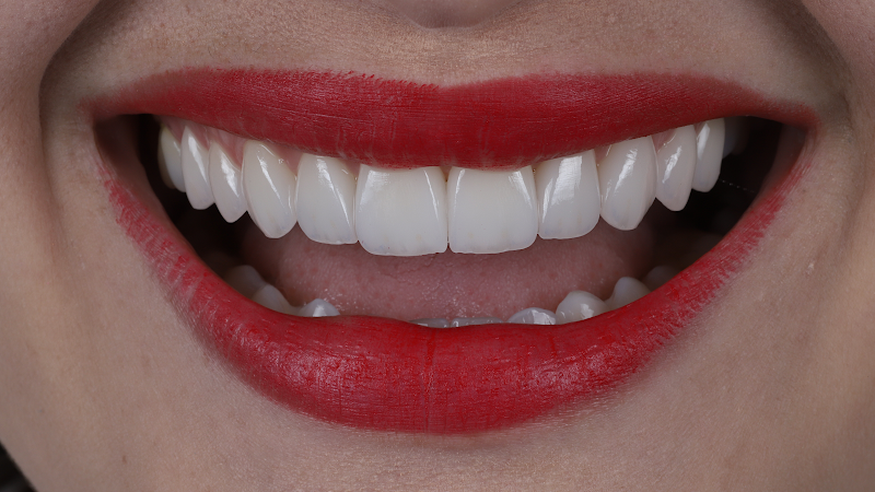 Foto 2 de Dr Fellype Feitosa - Consultório Odontológico