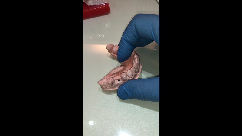 Foto 3 de Dr Fernando Portela - Implantes e Ortognática