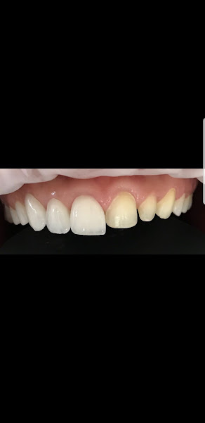 Foto 3 de Dr. Filipe R Cini - Odontologia Especializada / Implantodontia