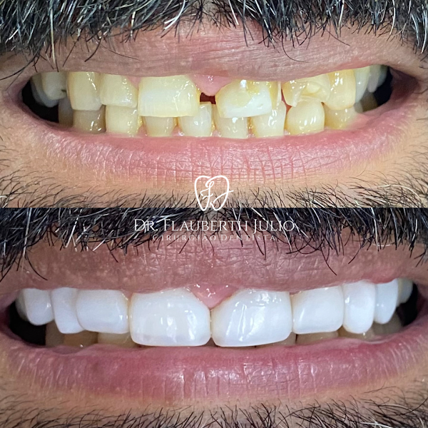 Foto 3 de Dr. Flauberth Julio (Cirurgião Dentista)