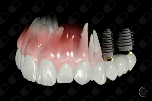 Foto 3 de Dr Flavio Fayad - Bucomaxilofacial