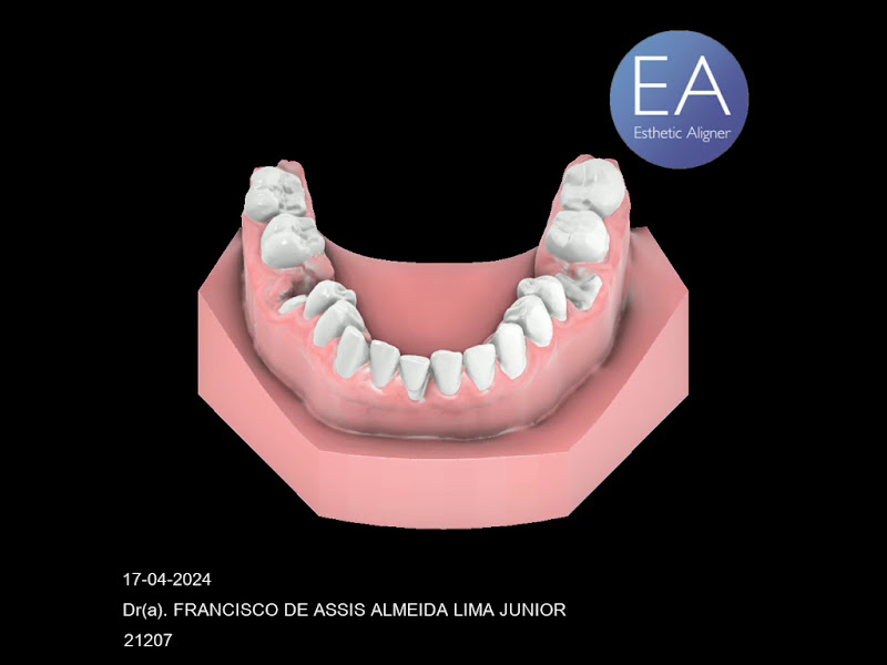 Foto 3 de Dr. Francisco de Assis Jr. | Estomatologista em Recife