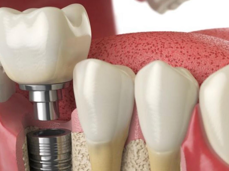 Foto 2 de Dr. Francisco Lopes da Silva Junior, Dentista