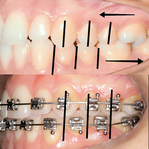 Foto 3 de Dr. Frederico Marcondes Ortodontia desde 1970
