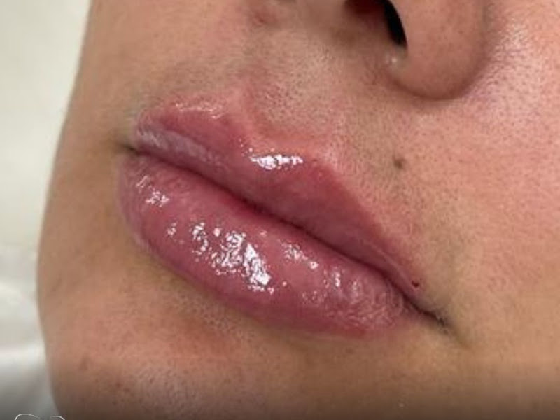 Foto de Dr. Gabriel Bismarck | Especialista em Harmonização Orofacial