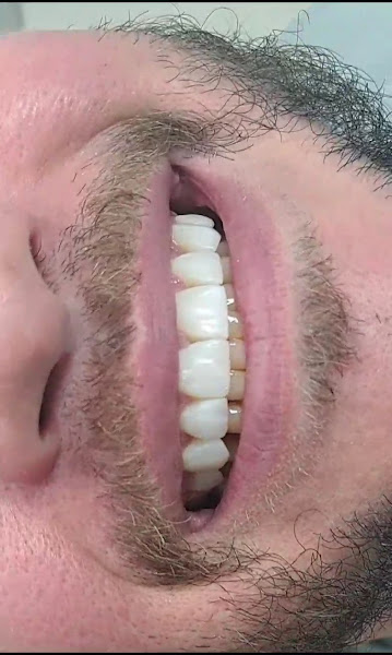 Foto 3 de Dr. Gabriel Foresti - Odontologia - Estética do Sorriso