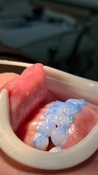 Foto 2 de Dr. Gabriel Oliveira | Ortodontia | Alinhadores | Estética Dental