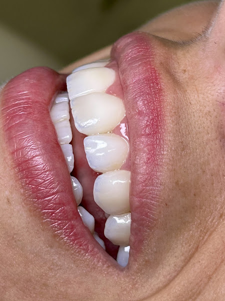 Foto 2 de Dr. Gabriel Urzelin | Odontologia Avançada | Implantes Dentários | Prótese | Lentes de Contato