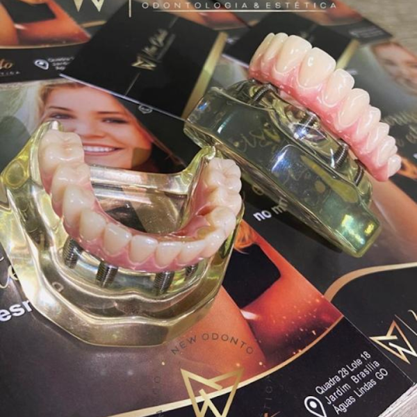 Foto 3 de Dr. Gean Carlos - Dentista em Brasília: Dentista em Ceilândia | Implante Dentário | Prótese Dentária | Clareamento Dental