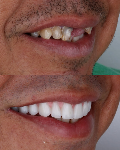 Foto 3 de Dr Geraldo Almeida | Dentista em Patos