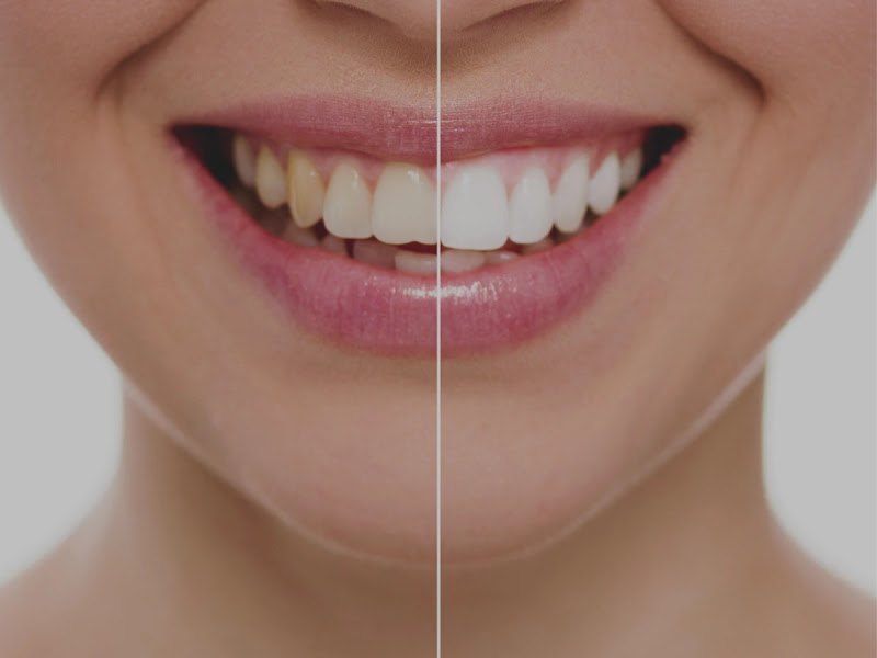 Foto 3 de Dr. Gerson Rezende - Dentista em Campo Grande