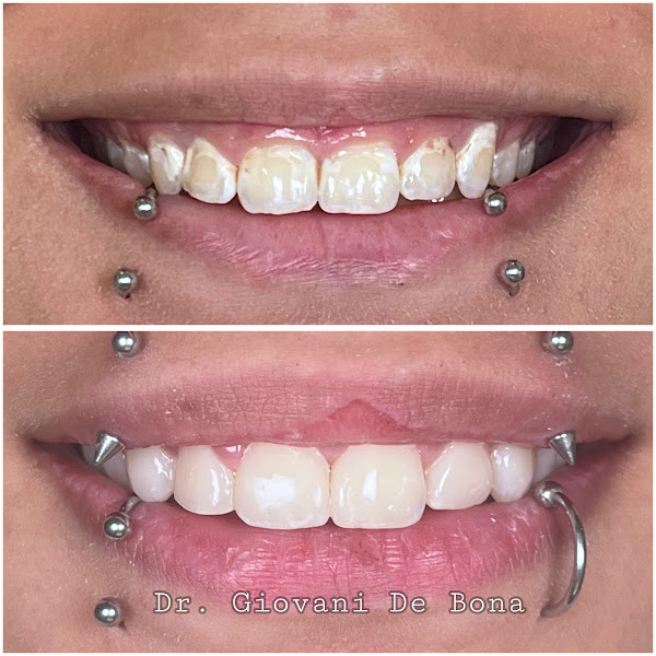 Foto 3 de Dr. Giovani De Bona - Cirurgião Dentista (DE BONA ODONTOLOGIA)