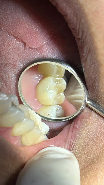 Foto 2 de Dr. Gladson Patrick • Cirurgião Dentista