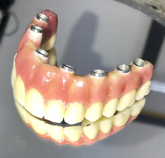 Foto 2 de Dr. Gonçalo Corral Dentista, Implantodontia, Periodontia, Estética Orofacial, Implantes Dentarios