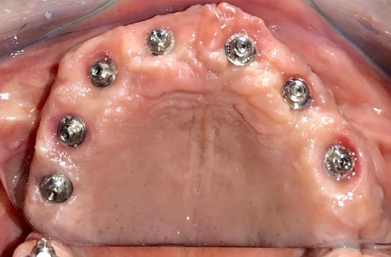 Foto 3 de Dr. Gonçalo Corral Dentista, Implantodontia, Periodontia, Estética Orofacial, Implantes Dentarios