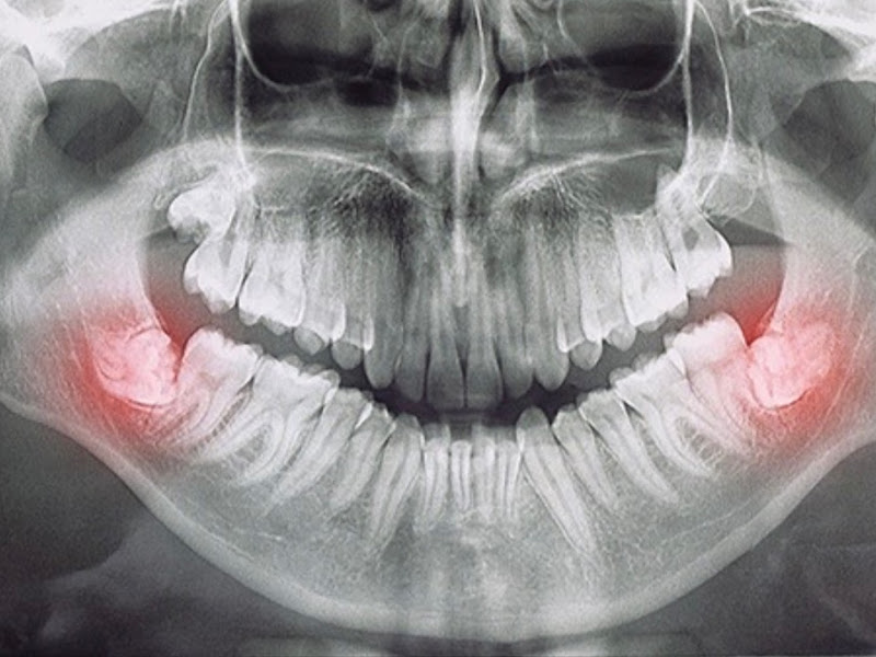 Foto de Dr Gruilherme Degani Battistetti - Cirurgião Buco-Maxilo-Facial
