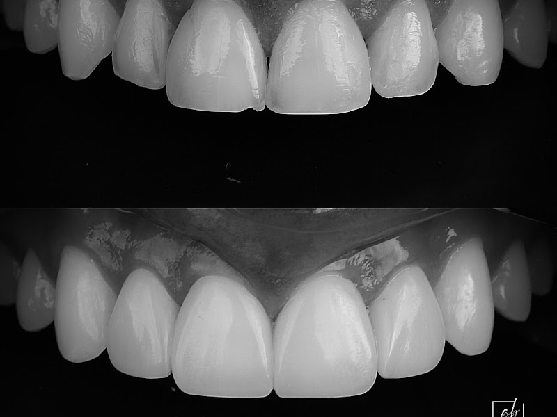Foto 3 de Dr. Guilherme Boselli - Odontologia Autoral