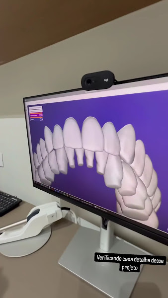 Foto 3 de Dr. Guilherme Sousa | Implantes e Lentes de Contato Dental em Uberlândia