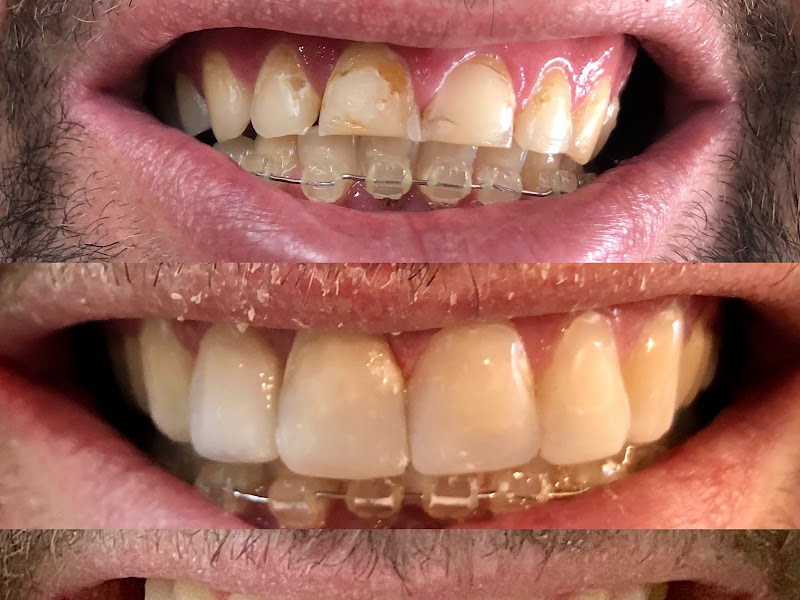 Foto 3 de Dr. Guilherme Torres de Campos - Dentista Mogi Guaçu