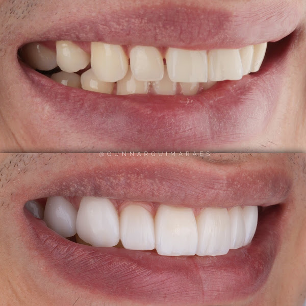 Foto 3 de Dr. Gunnar Guimarães