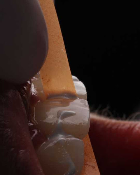 Foto 2 de Dr. Gustavo Duarte - Especialista em Lentes e Facetas de Resina | Recife - PE