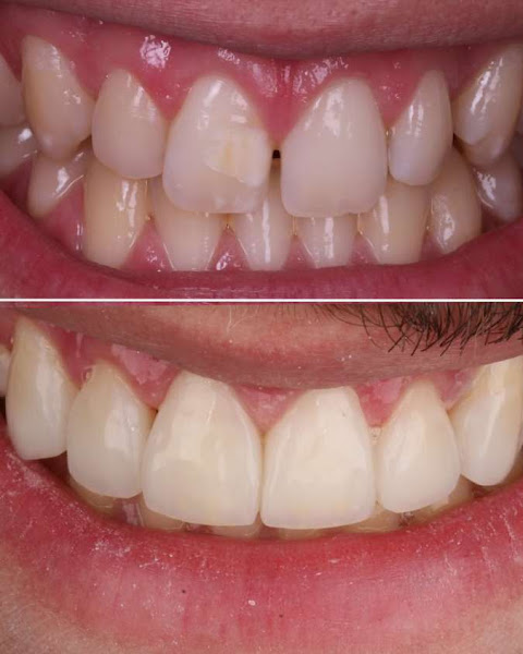 Foto 4 de Dr. Gustavo Duarte - Especialista em Lentes e Facetas de Resina | Recife - PE