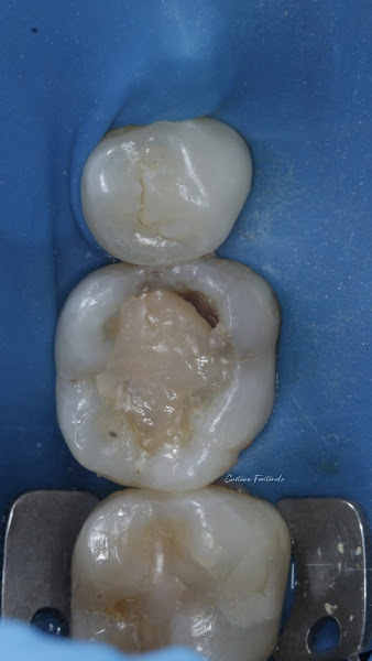 Foto 2 de Dr. Gustavo Fontenele - Cirurgião-Dentista