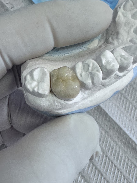 Foto 3 de Dr Gustavo Macedo - Implantodontia e Estética Dental