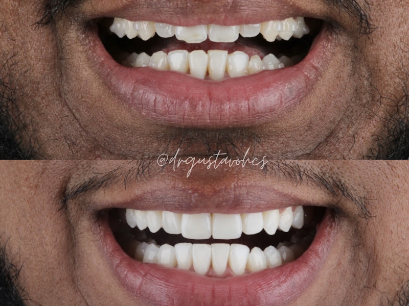 Foto 3 de Dr. Gustavo Mendes Nogueira - Dentista