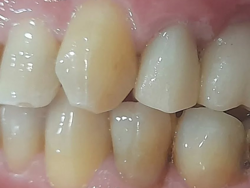 Foto 7 de Dr. Gustavo Rosa - Dentista Belo Horizonte