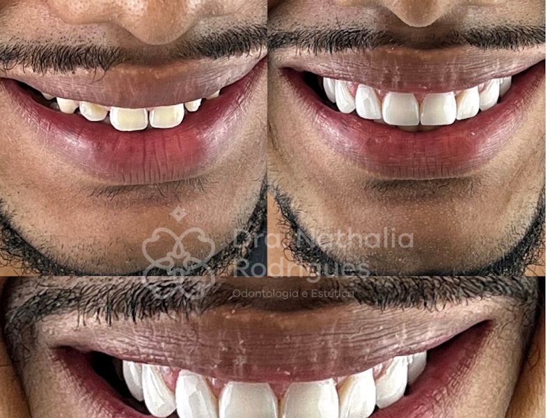 Foto 8 de Dr. Gustavo Rosa - Dentista Belo Horizonte