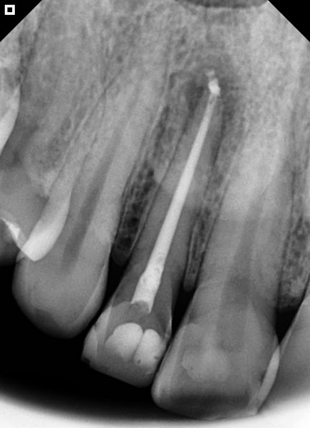 Foto 2 de Dr Gustavo Tavares - Urgencia Odontologica em Sobral